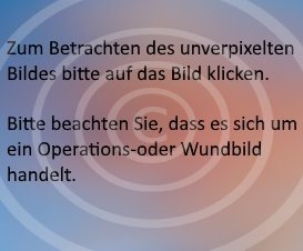 Karpaldach verpixelt