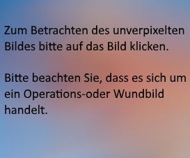 Wund und Operationsbild Hand beim Kind