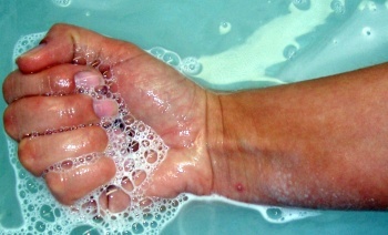 Drei bis f&uuml;nf mal t&auml;glich je 5 Minuten leichte Beuge- und Streckbewegungen in lauwarmem Wasser